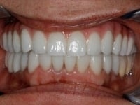 Konig Center for Cosmetic & Comprehensive Dentistry smile photos
